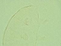 Pseudechiniscus juanitae image