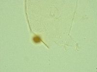 Pseudechiniscus juanitae image