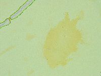 Pseudechiniscus juanitae image