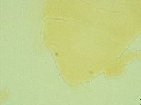 Pseudechiniscus juanitae image