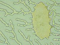 Pseudechiniscus juanitae image