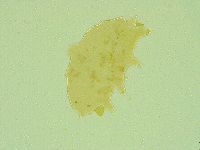 Pseudechiniscus juanitae image