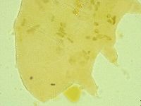 Pseudechiniscus juanitae image