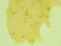 Pseudechiniscus juanitae image