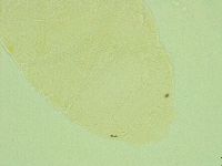 Pseudechiniscus juanitae image