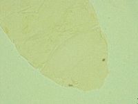 Pseudechiniscus juanitae image