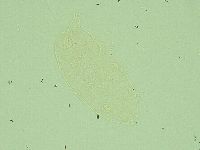 Pseudechiniscus juanitae image
