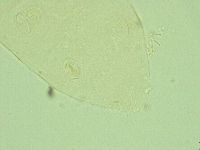 Pseudechiniscus juanitae image