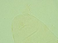 Pseudechiniscus juanitae image