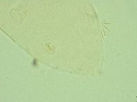 Pseudechiniscus juanitae image