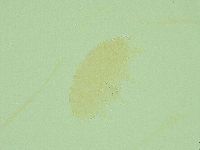 Pseudechiniscus juanitae image