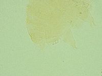 Pseudechiniscus juanitae image