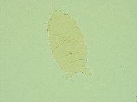 Pseudechiniscus juanitae image