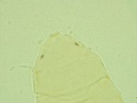 Pseudechiniscus juanitae image