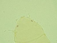 Pseudechiniscus juanitae image