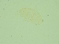 Pseudechiniscus juanitae image