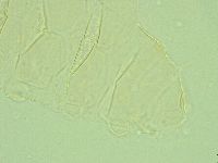 Pseudechiniscus juanitae image