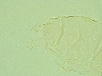 Pseudechiniscus juanitae image