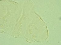 Pseudechiniscus juanitae image