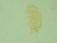 Pseudechiniscus juanitae image