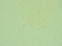 Pseudechiniscus ramazzottii image
