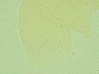 Antechiniscus perplexus image
