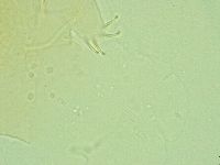 Antechiniscus perplexus image