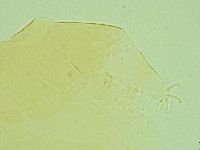 Pseudechiniscus novaezeelandiae image
