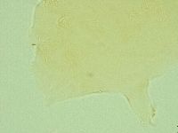Pseudechiniscus novaezeelandiae image
