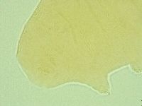 Pseudechiniscus novaezeelandiae image
