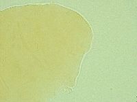 Pseudechiniscus novaezeelandiae image