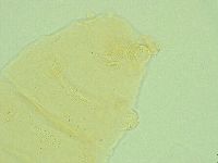 Pseudechiniscus novaezeelandiae image