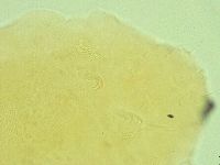 Pseudechiniscus novaezeelandiae image
