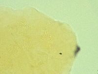 Pseudechiniscus novaezeelandiae image