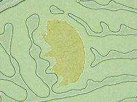 Pseudechiniscus juanitae image