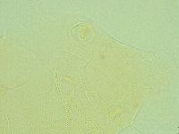 Pseudechiniscus novaezeelandiae image
