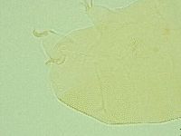 Pseudechiniscus novaezeelandiae image