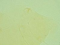 Pseudechiniscus novaezeelandiae image