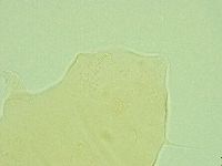 Pseudechiniscus novaezeelandiae image