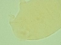 Pseudechiniscus novaezeelandiae image