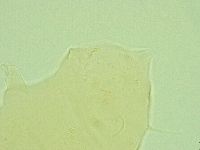 Pseudechiniscus novaezeelandiae image