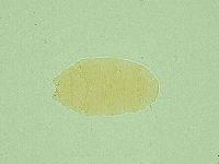 Pseudechiniscus suillus image