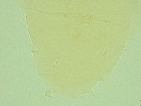 Pseudechiniscus novaezeelandiae image