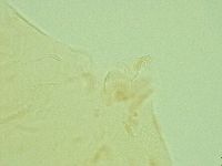 Pseudechiniscus novaezeelandiae image
