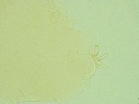 Pseudechiniscus novaezeelandiae image
