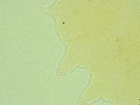 Pseudechiniscus novaezeelandiae image