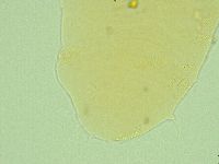 Pseudechiniscus novaezeelandiae image