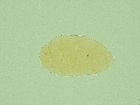 Pseudechiniscus novaezeelandiae image