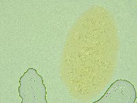 Pseudechiniscus novaezeelandiae image