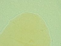 Pseudechiniscus novaezeelandiae image